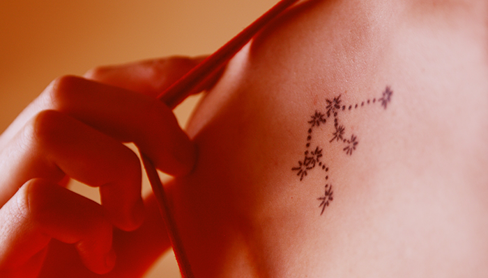 How do tattoo removals work?